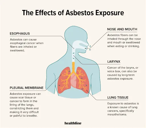 The Effects of Asbestos Exposure